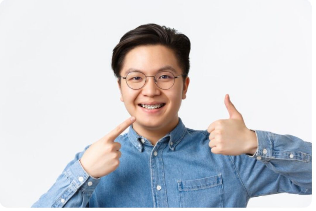 how long do braces actually take